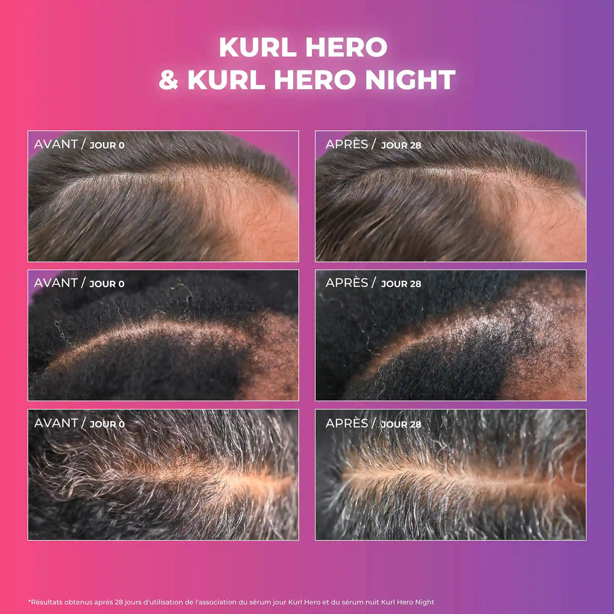 Duo Kurl Hero Day & Night - Sérum de jour fortifiant + Sérum de nuit réparateur