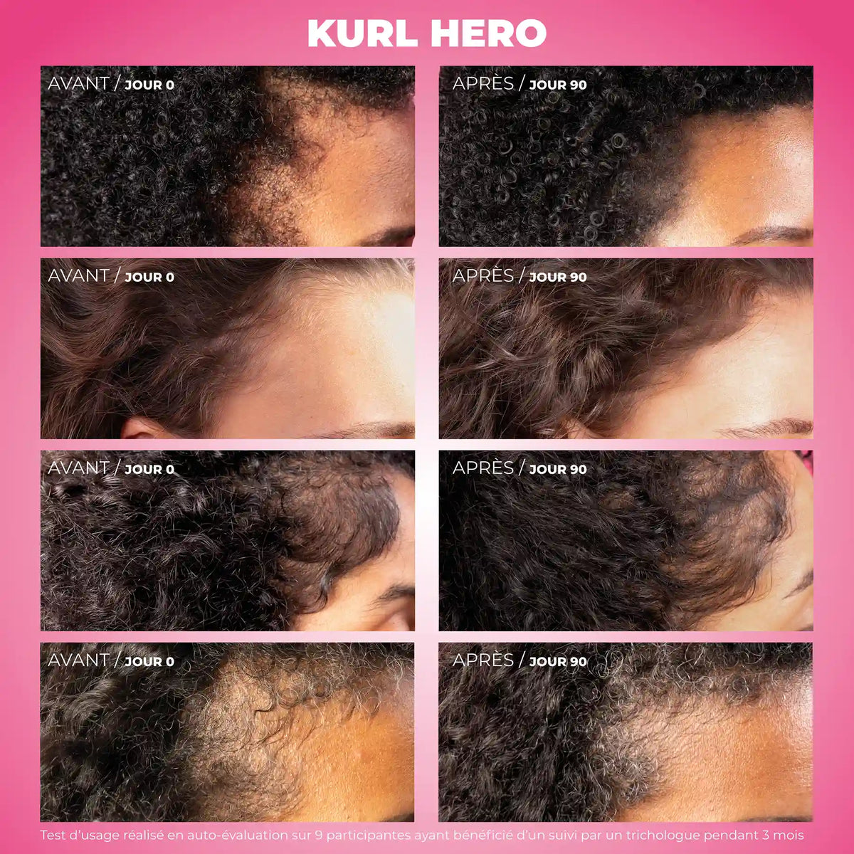 Kurl Hero - Sérum anti-chute, croissance et densifiant